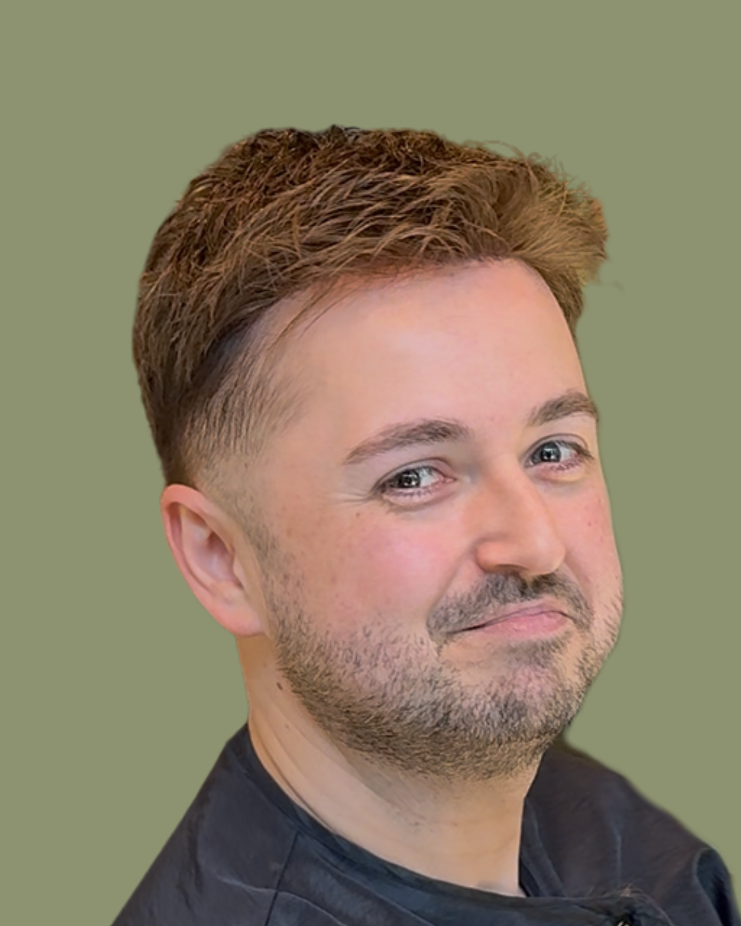 Close-up of a natural-looking hairline after a hair system has been fitted and blended